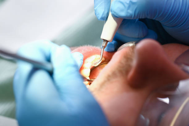 Best Cracked Tooth Emergency Dentist  in Fairbanks, AK